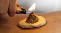 【艾灸知識(shí)】十大常見艾灸不良反應(yīng)，及處理方法！建議收藏！